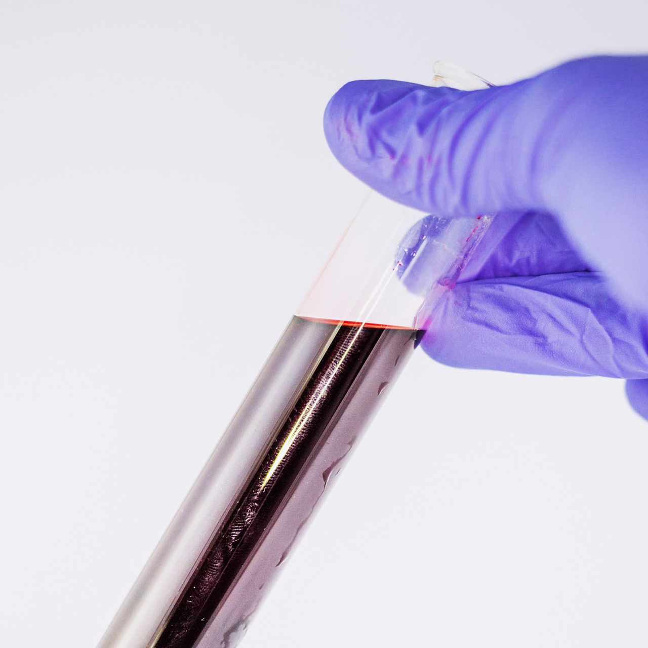 Nih Blood Test Method May Predict Alzheimer S Protein Deposit In Brain Pic 3 3 20du Blood 1291132 1920 Pixabay 5e5e77b441883