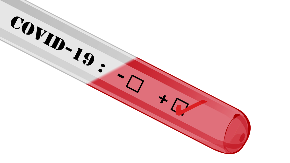 Cms Announces Expanded Coverage For Essential Diagnostic Services Amid Covid 19 Public Health Emergency Healthcare Purchasing News