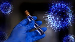 Early Antibody Testing Suggests Covid 19 Infections In L a County Greatly Exceed Documented Cases Pic 4 21 20du Covid 19 5000502 1920 Pixabay 5e9eff34d12d8 Early Antibody Testing Suggests Covid 19 Infections In L a County Greatly Exceed Documented Cases Pic 4 21 20du Covid 19 5000502 1920 Pixabay 5e9eff34d12d8