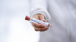 Fda Authorizes First Covid 19 Test For Patient At Home Sample Collection Pic 4 22 20du Test Tube 5065426 1920 Pixabay