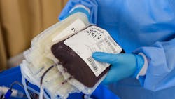 Premier Survey Finds Blood Supply Needs To Increase As Much As 50 As Elective Procedures Return Pic 4 30 20du Blood 4951009 1920 Pixabay 5eaad88051762 Premier Survey Finds Blood Supply Needs To Increase As Much As 50 As Elective Procedures Return Pic 4 30 20du Blood 4951009 1920 Pixabay 5eaad88051762