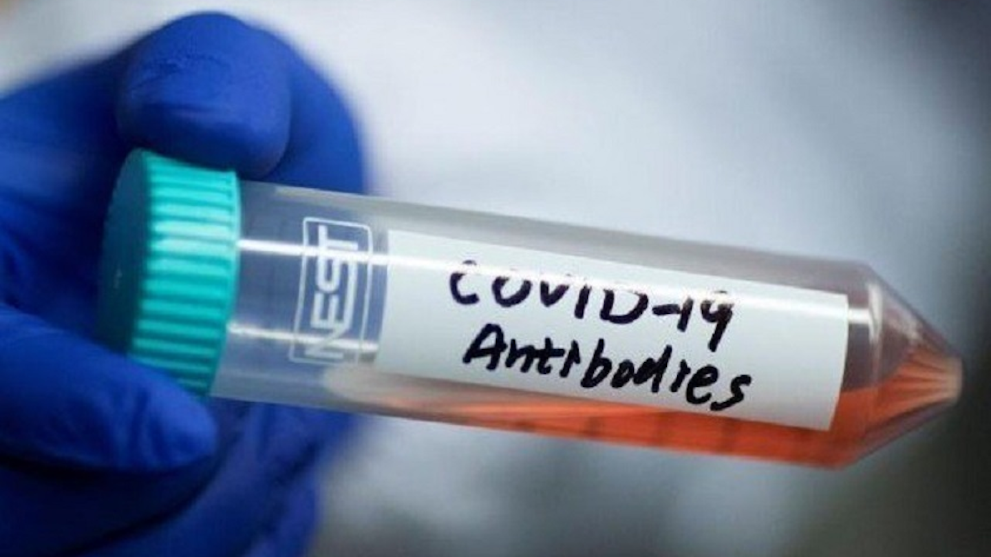 COVID19 antibody test now directly available through