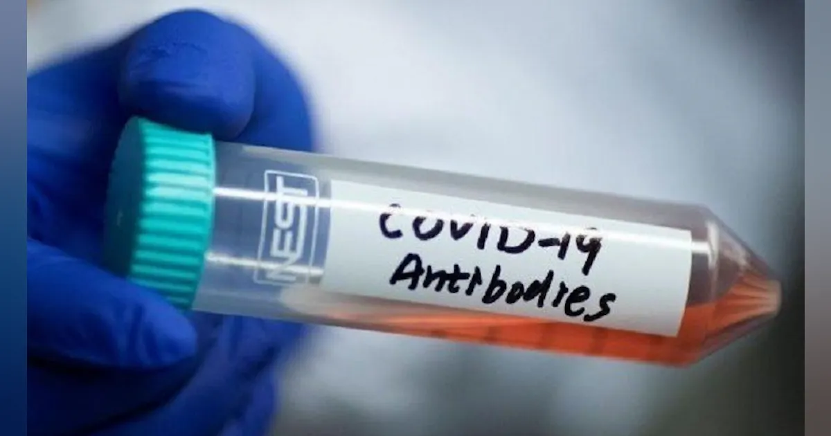 COVID-19 antibody test now directly available through LabCorp.com | HPN ...