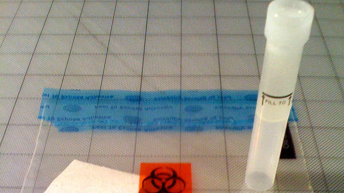 At Home Sars Co V 2 Diagnostic Tests Could Be A Breakthrough With Possible Limitations Pic 5 13 20du 2865674738 D577a64385 O Fda Flickr 5ebc1317d57dc