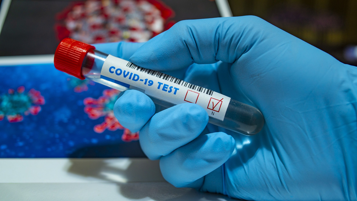 Fda Authorizes First Diagnostic Test Using At Home Collection Of Saliva Specimens Healthcare Purchasing News