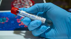 Fda Authorizes First Diagnostic Test Using At Home Collection Of Saliva Specimens Pic 5 12 20du Covid 19 5070657 1920 Pixabay