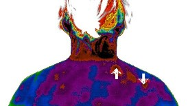 Honeywell Introduces Ai Driven Thermal Imager Detects Elevated Body Temperature Pic 5 13 20du 7658610548 E180b68181 O Fda Flickr 5ebc0fee93c89