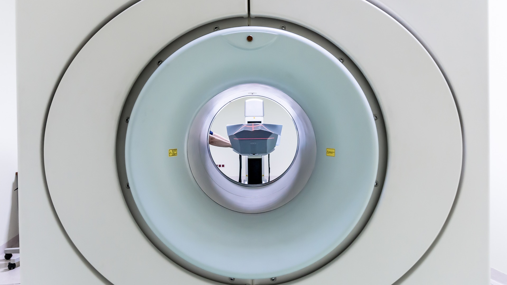 Mri Technique Could Reduce Need For Radiation In Measuring Tumor Response To Chemotherapy Pic 5 7 20du Mri 2813914 1920 Pixabay 5eb416e778f50