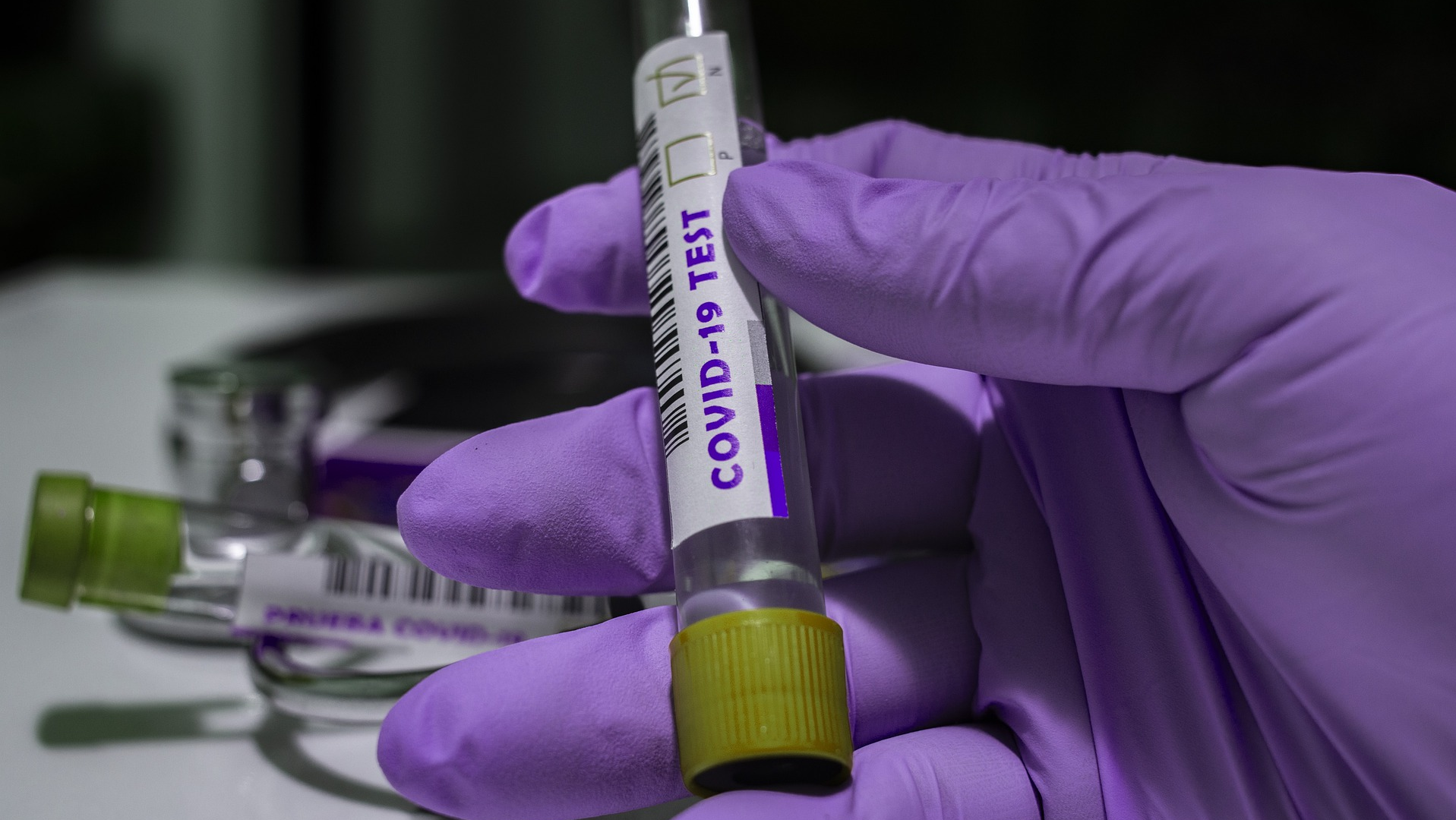 Fda Takes Steps To Streamline Development Of Tests With At Home Sample Collection Pic 6 1 20du Covid 19 5070656 1920 Pixabay 5ed5120e89298