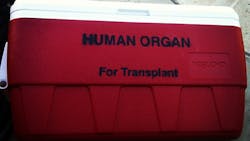 Hhs Announces New Organ Transplant Guidance Pic 6 26 20du 7834342386 7b17d96c15 O Fda Flickr 5ef60fe7ebd0d Hhs Announces New Organ Transplant Guidance Pic 6 26 20du 7834342386 7b17d96c15 O Fda Flickr 5ef60fe7ebd0d