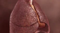 Lung Development May Explain Why Some Non Smokers Get Copd And Some Heavy Smokers Do Not Pic 6 11 20du 3517333255 1f1c27b05a O Fda Flickr