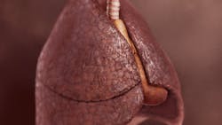 Lung Development May Explain Why Some Non Smokers Get Copd And Some Heavy Smokers Do Not Pic 6 11 20du 3517333255 1f1c27b05a O Fda Flickr 5ee24dac9d568 Lung Development May Explain Why Some Non Smokers Get Copd And Some Heavy Smokers Do Not Pic 6 11 20du 3517333255 1f1c27b05a O Fda Flickr 5ee24dac9d568