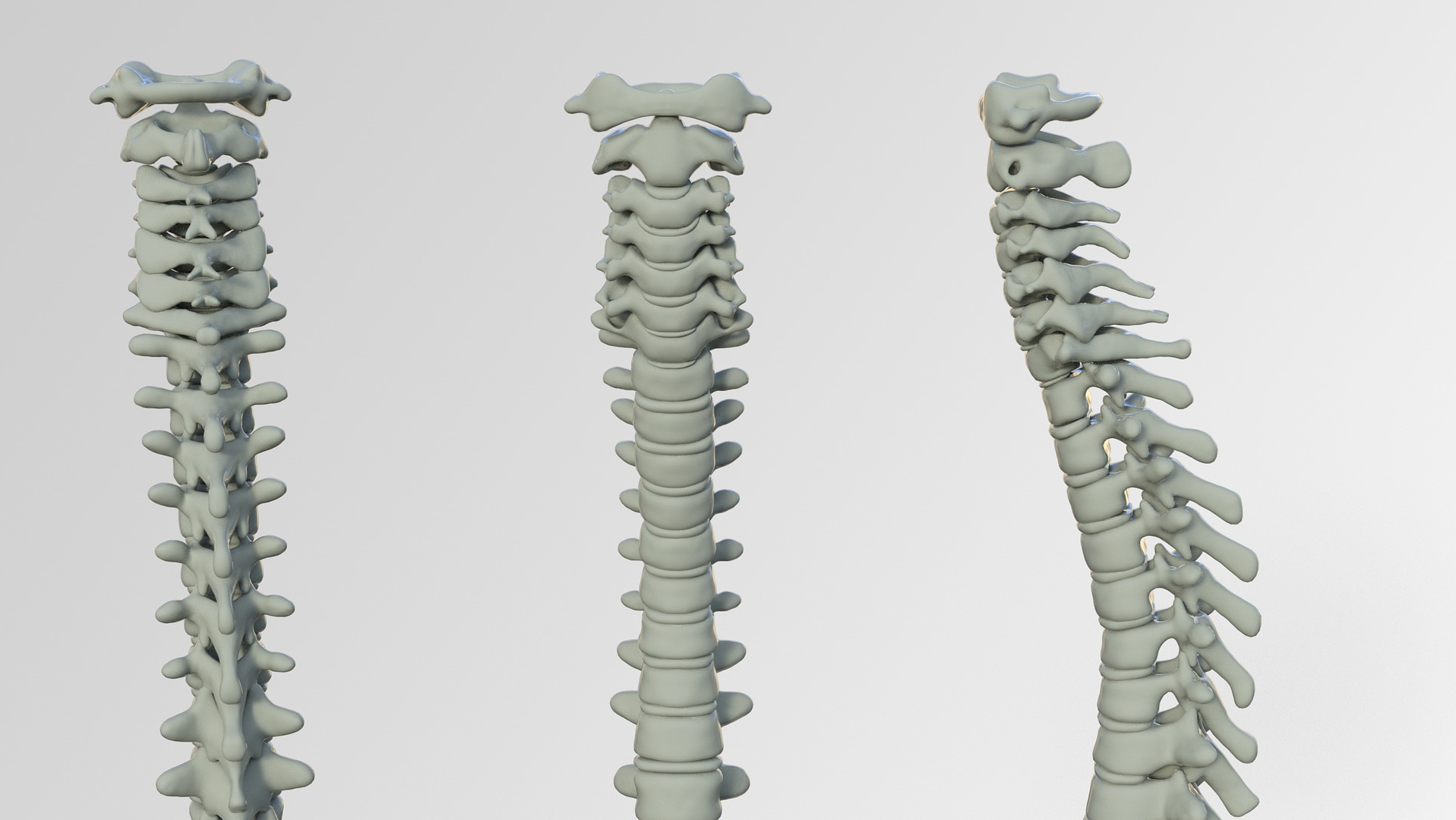 Study Finds Similar Short Term Outcomes With Common Minimally Invasive Spine Procedures Pic 6 15 20du Spine 3220105 1920 Pixabay 5ee7843278dd6