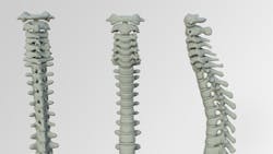 Study Finds Similar Short Term Outcomes With Common Minimally Invasive Spine Procedures Pic 6 15 20du Spine 3220105 1920 Pixabay 5ee7843278dd6 Study Finds Similar Short Term Outcomes With Common Minimally Invasive Spine Procedures Pic 6 15 20du Spine 3220105 1920 Pixabay 5ee7843278dd6