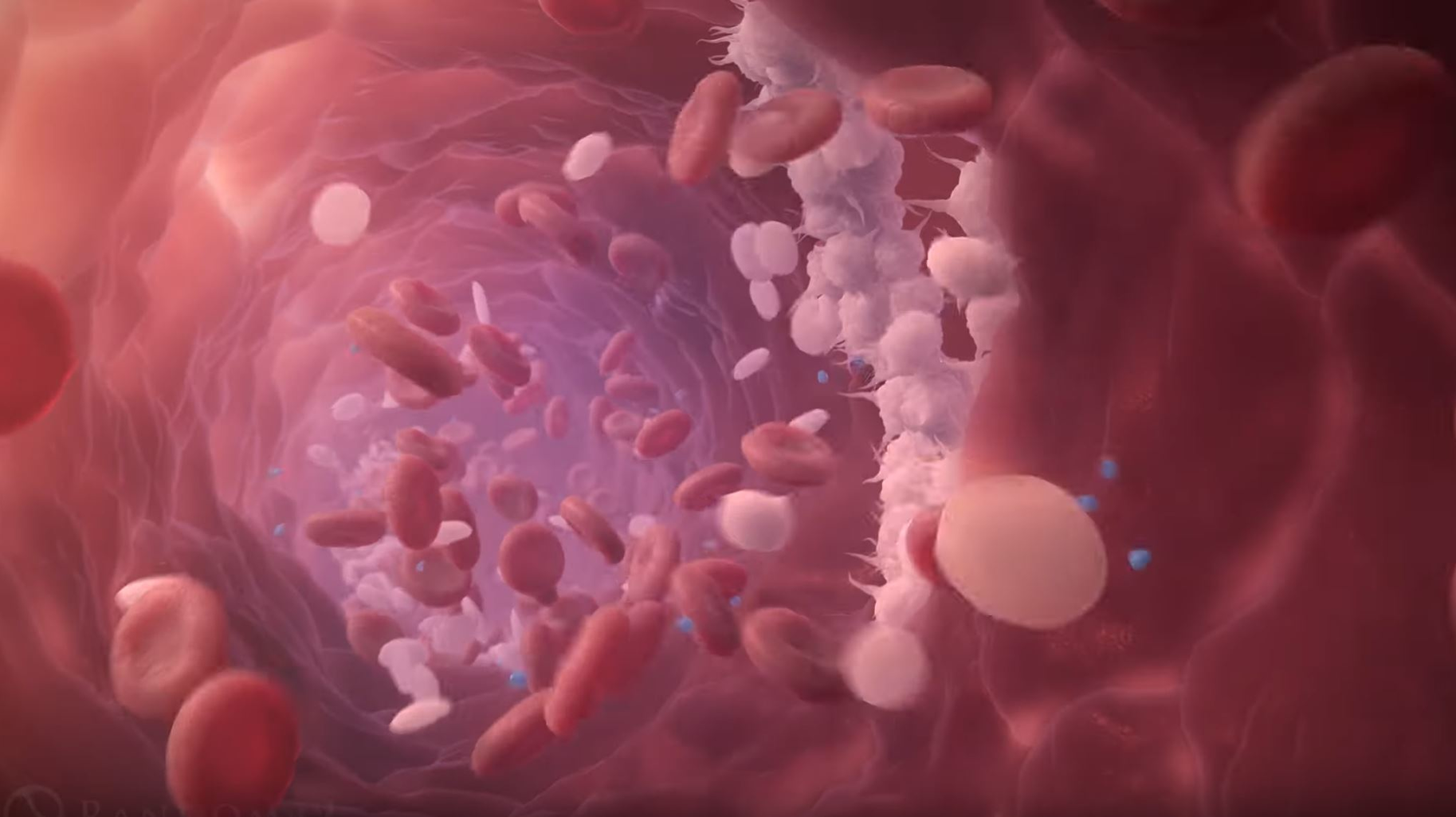 Study Ties Stroke Related Brain Blood Vessel Abnormality To Gut Bacteria Pic 6 8 20du 49046456487 C0f5fbc010 O Fda Flickr 5ede4bd3132b5