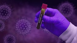 Bd Launches Portable Rapid Poc Antigen Test To Detect Sars Co V 2 In 15 Minutes Pic 7 6 20du Covid 19 4982913 1920 Pixabay 5f032ee2c42a3 Bd Launches Portable Rapid Poc Antigen Test To Detect Sars Co V 2 In 15 Minutes Pic 7 6 20du Covid 19 4982913 1920 Pixabay 5f032ee2c42a3