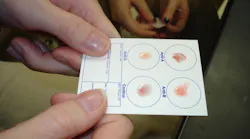 Fda Issues Emergency Use Authorization For Point Of Care Antigen Test Pic 7 7 20du 4366619094 C8dc70d9b9 O Fda Flickr