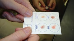 Fda Issues Emergency Use Authorization For Point Of Care Antigen Test Pic 7 7 20du 4366619094 C8dc70d9b9 O Fda Flickr 5f0480261792a Fda Issues Emergency Use Authorization For Point Of Care Antigen Test Pic 7 7 20du 4366619094 C8dc70d9b9 O Fda Flickr 5f0480261792a