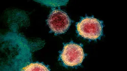 Mit Team Collaborates With 3 M To Develop Rapid Covid 19 Low Cost Diagnostic Test Pic 7 15 20du 49656837931 97cef4da9e O Fda Flickr
