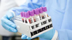 Simple Blood Test Can Predict Severity Of Covid 19 For Some Patients Pic 7 13 20du Blood 4944421 1920 Pixabay