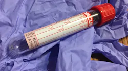 Cb Ctest7 17 20blood 1761832 1920