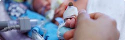 Iodine Exposure In The Nicu May Lead To Decrease In Thyroid Function Pic 7 8 20du 14536606108 1de9d5de28 O Fda Flickr 5f05cc4925e1d Iodine Exposure In The Nicu May Lead To Decrease In Thyroid Function Pic 7 8 20du 14536606108 1de9d5de28 O Fda Flickr 5f05cc4925e1d