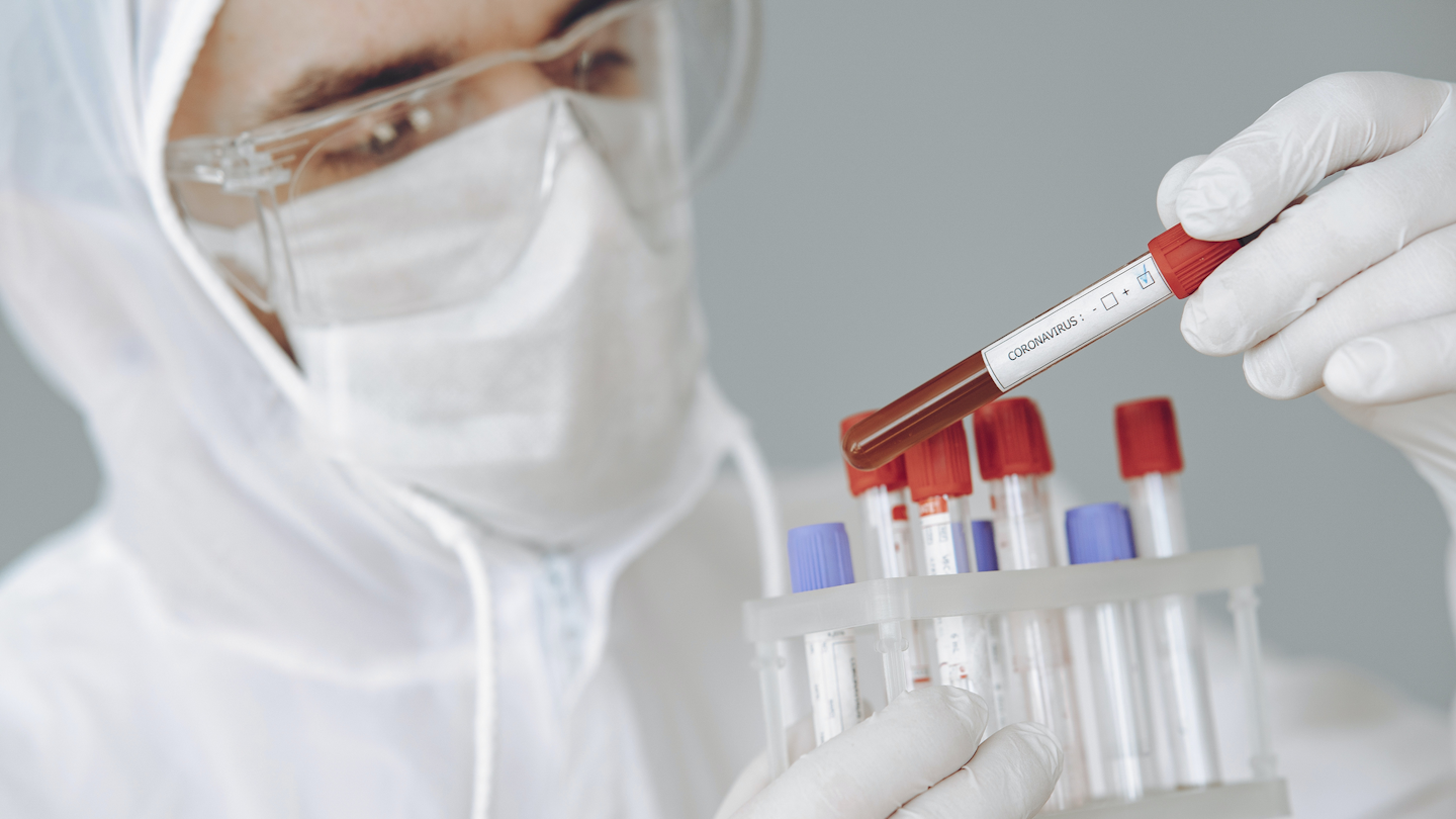 Pooled sample testing and screening testing for covid-19 | healthcare