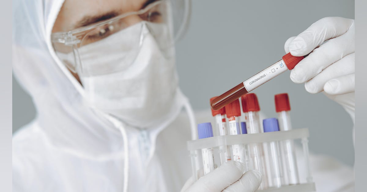 Pooled sample testing and screening testing for COVID-19 | HPN Online