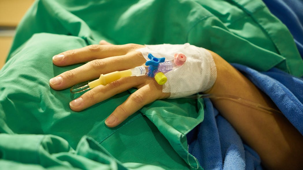 Punctured lung affects one in a 100 hospitalized COVID19 patients