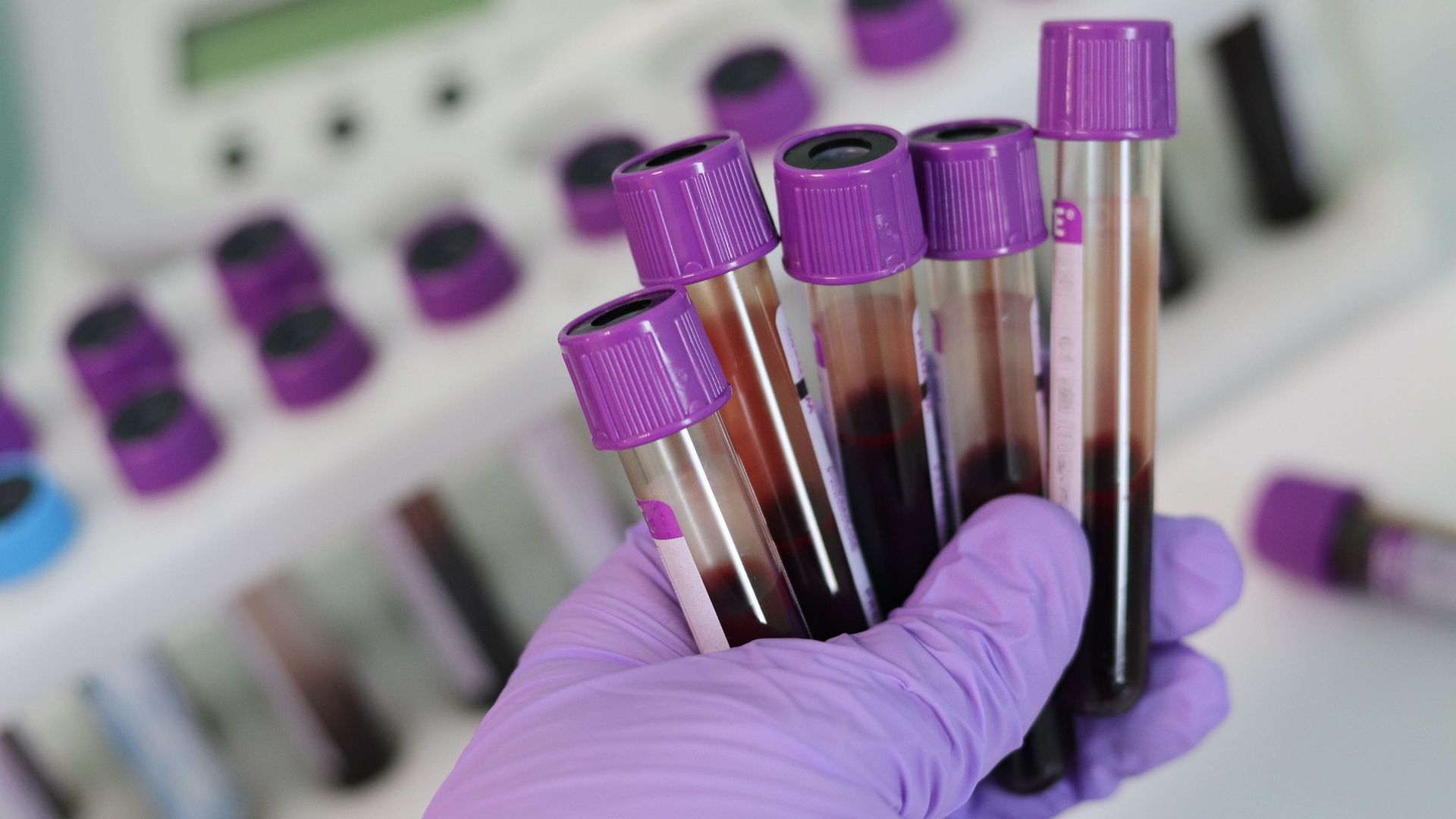 Image by Belova59 from Pixabay