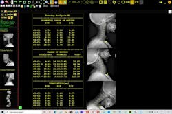 2020 Imaging Digital Penning Analysis Tool 2020 Imaging Digital Penning Analysis Tool