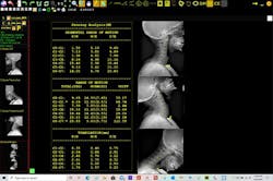 2020 Imaging Digital Penning Analysis Tool 2020 Imaging Digital Penning Analysis Tool