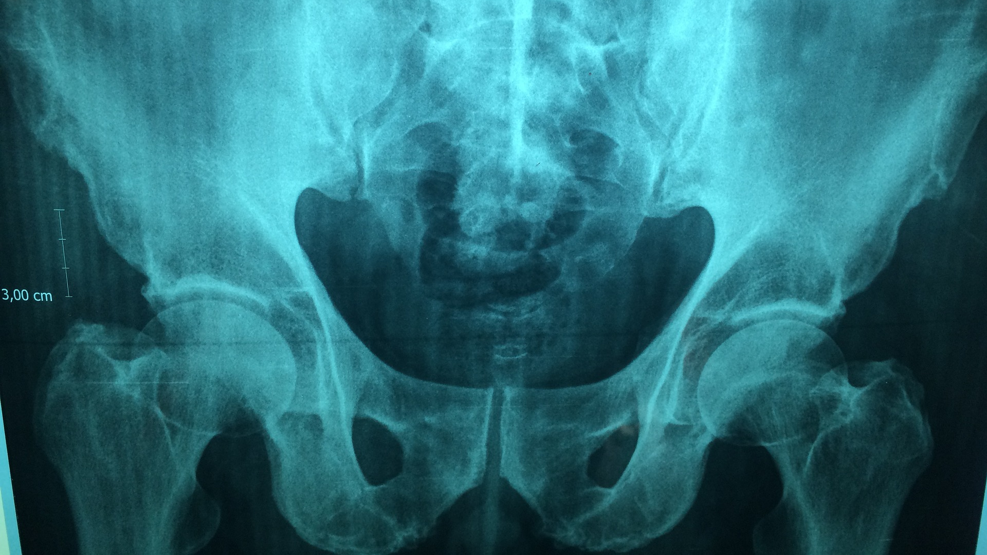 Image by Dr. Manuel Gonz&aacute;lez Reyes from Pixabay