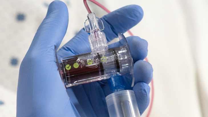 Photo courtesy of Magnolia Medical Technologies