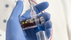 Photo courtesy of Magnolia Medical Technologies Photo courtesy of Magnolia Medical Technologies