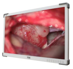 55” monitor from FSN Medical Technologies 55” monitor from FSN Medical Technologies