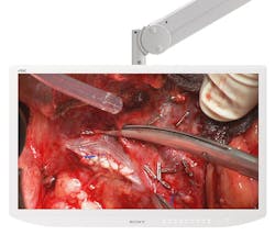 Sony Lmd3200md 6 Sony Lmd3200md 6