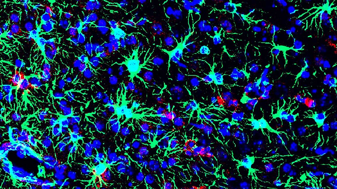 Photo courtesy of NIH