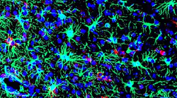 Photo courtesy of NIH