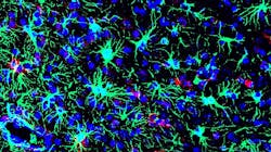 Photo courtesy of NIH Photo courtesy of NIH