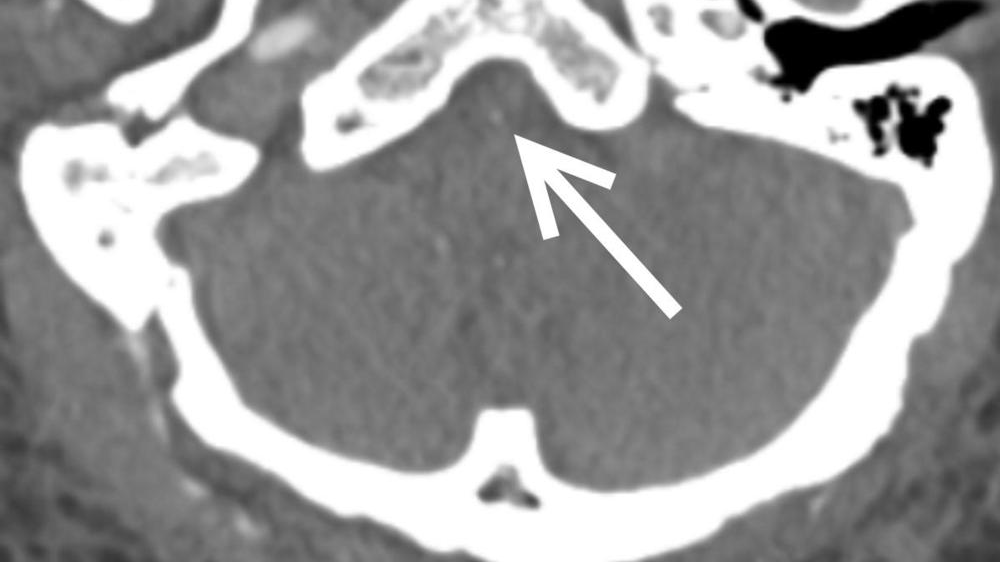 Photo courtesy of RSNA