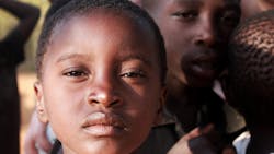Worldwide Measles Deaths Climb 50 Percent From 2016 2019 Claim More Than 207 500 Lives In 2019 Pic 11 13 20du Child 4617142 1920 Pixabay 5faeb2d67913c Worldwide Measles Deaths Climb 50 Percent From 2016 2019 Claim More Than 207 500 Lives In 2019 Pic 11 13 20du Child 4617142 1920 Pixabay 5faeb2d67913c