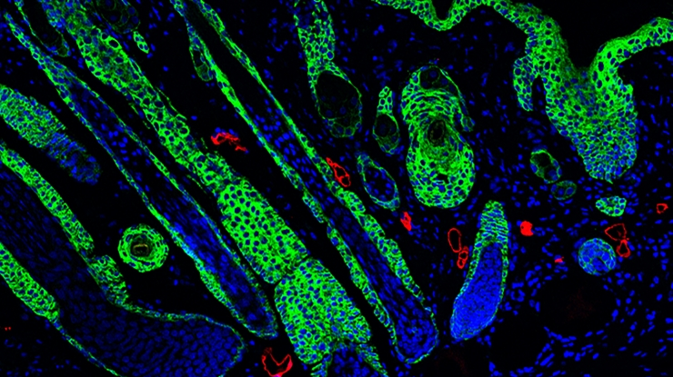 Photo courtesy of UCLA Health