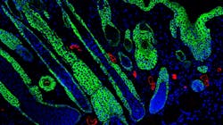 Photo courtesy of UCLA Health Photo courtesy of UCLA Health