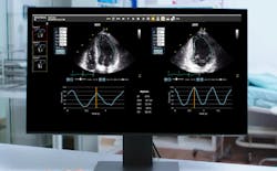 Konika Minolta L Vivo Strain From Di A’s L Vivo Cardiac Toolbox On Exa® Cardio Pacs Konika Minolta L Vivo Strain From Di A’s L Vivo Cardiac Toolbox On Exa® Cardio Pacs