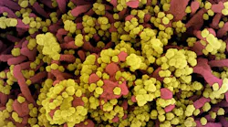 Photo courtesy of NIAID and NIH