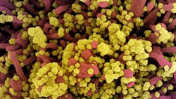 Photo courtesy of NIAID and NIH Photo courtesy of NIAID and NIH