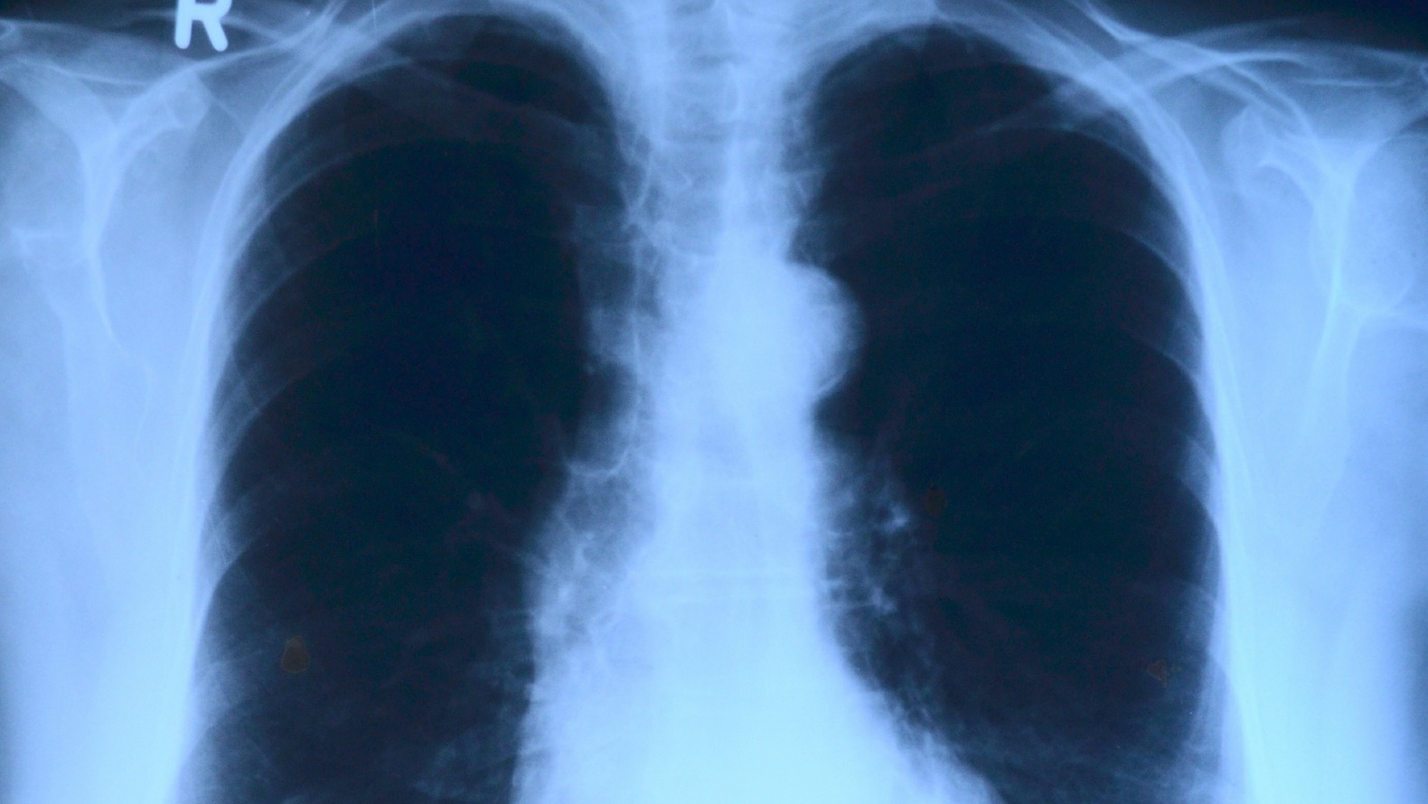 Image by toubibe from Pixabay