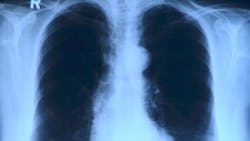 Image by toubibe from Pixabay Image by toubibe from Pixabay