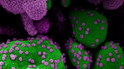 Photo courtesy of NIH